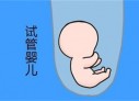 培养烟台捐卵宝宝艺术细胞的小技巧